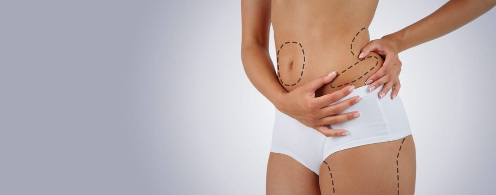 Liposuction Treatment in Ahmedabad,Gujarat