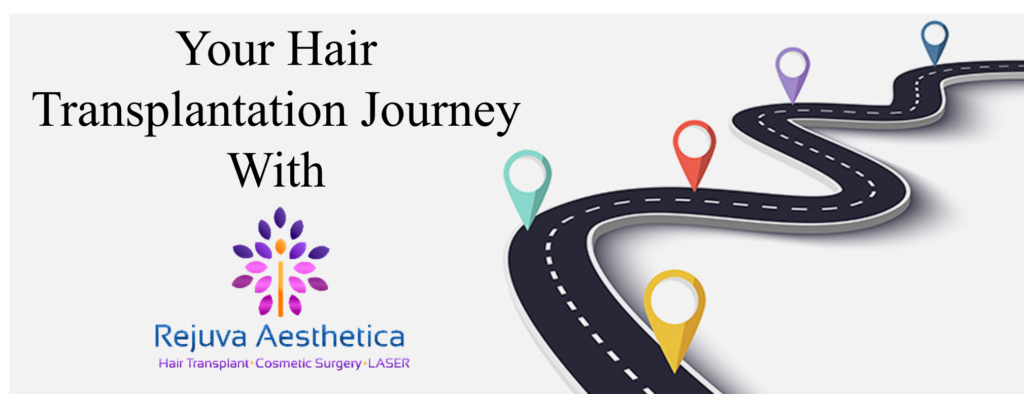 Steps in Hair Transplant,Hair Transplant Journey