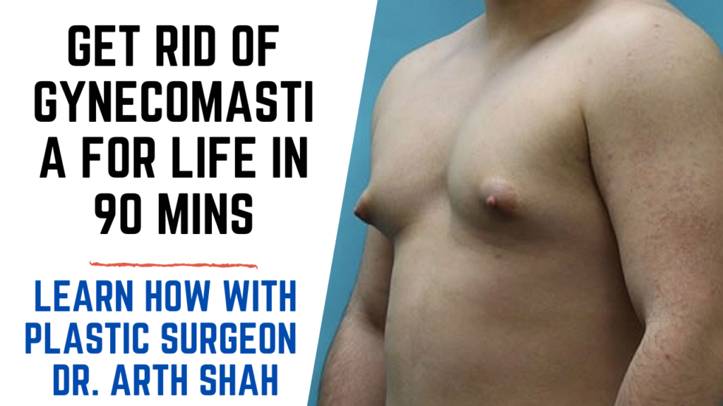 Get Rid of Gynecomastia for life in 90 mins learn how with plastic surgeon Dr. Arth Shah in Gujarat