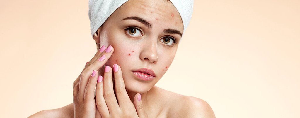 Best Skin Doctor in Ahmedabad for Acne Treatment in Ahmedabad