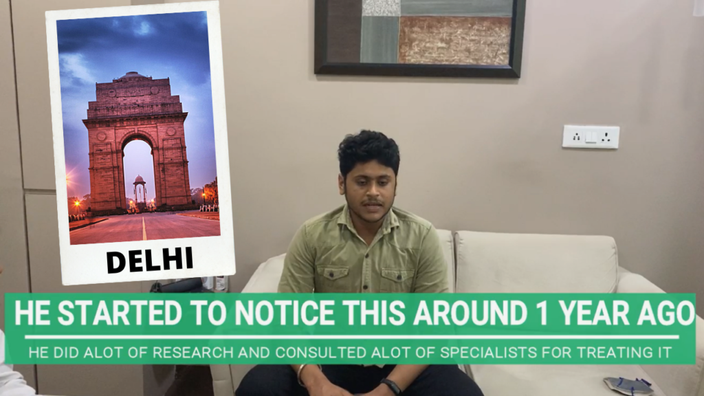 GYNECOMASTIA PATIENT FROM DELHI CAME TO AHMEDABAD TO GET TREATED FOR GYNECOMASTIA SURGERY IN INDIA