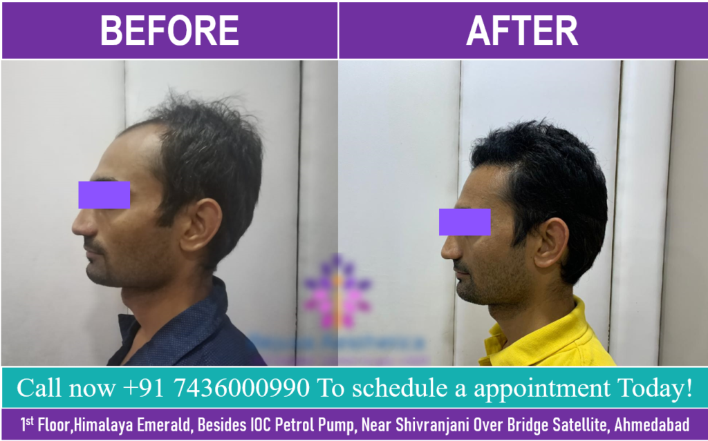 Hair Specialist Doctor in Maninagar Ahmedabad  Dr Batras Homeopathy  Clinic