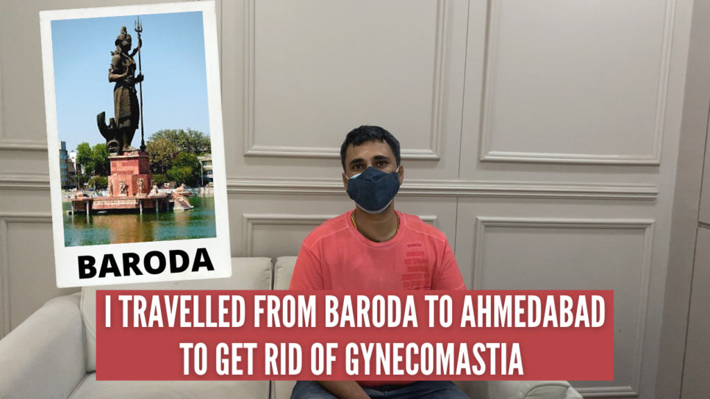 Gynecomastia Treatment in Baroda,India