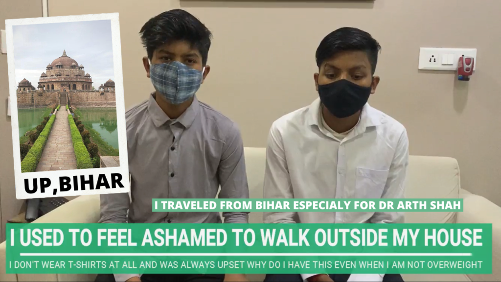 3 Brother from Bihar Came to Ahmedabad to get their Gynecomastia by India’s Top Plastic Surgeon