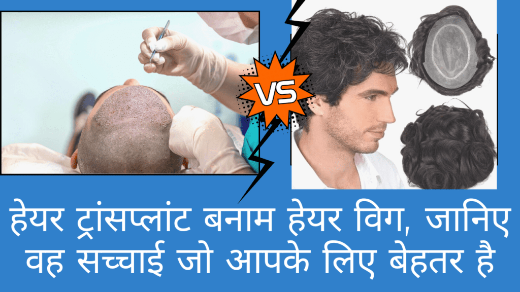 Unbiased Comparison Hair Transplant VS Hair Wig Explained in Hindi by Hair Transplant Surgeon India