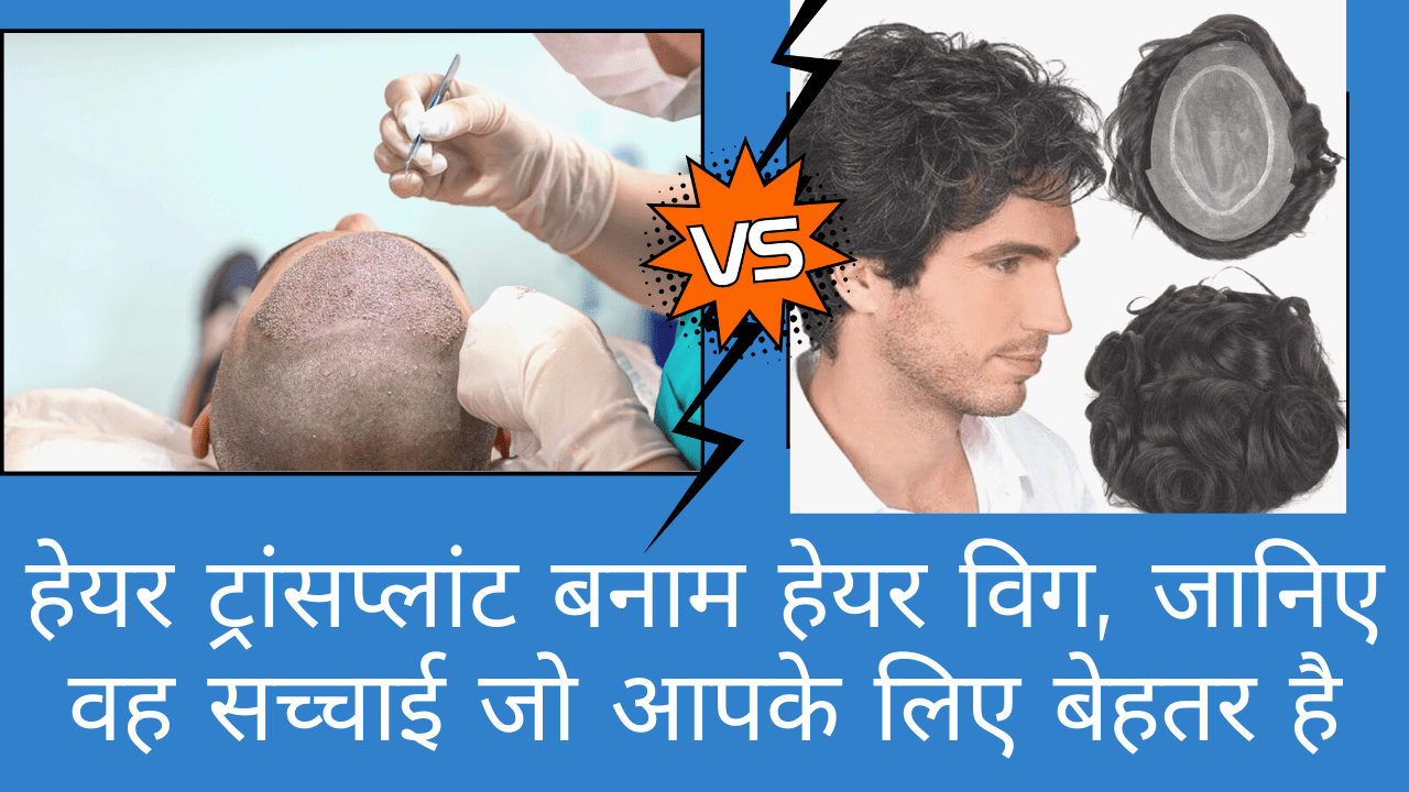 Hair Transplant or Hair Wig which is better for you