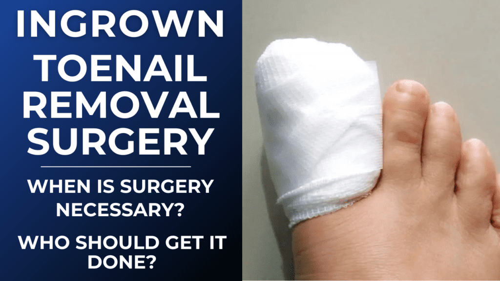 what-is-ingrown-toenail-removal-surgery-how-does-it-work-does-it-hurt