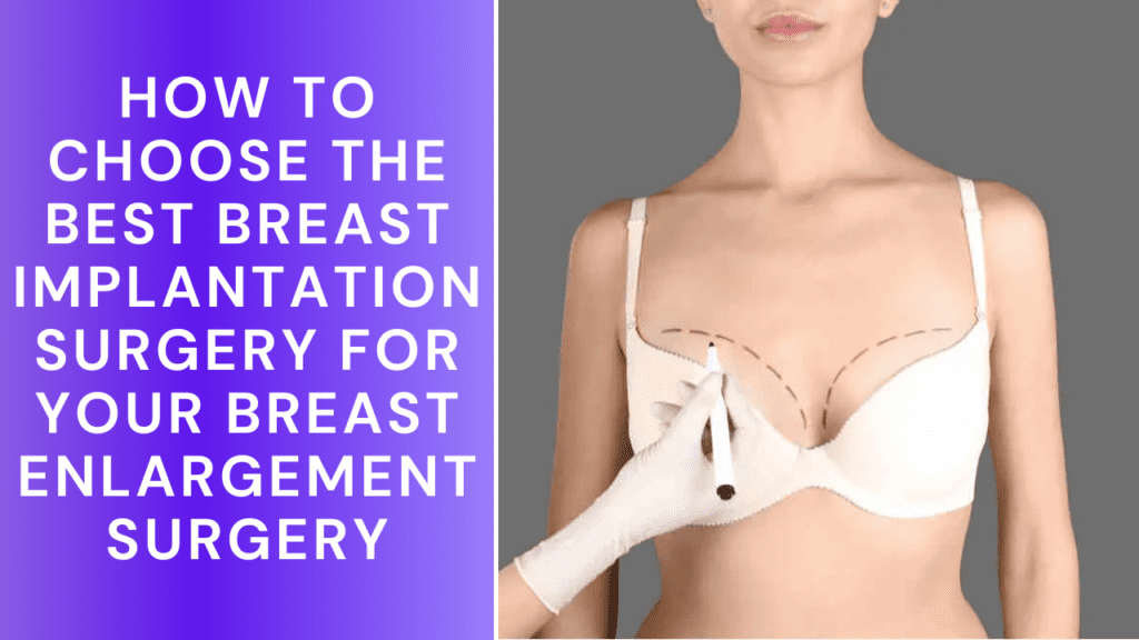 How to choose the Best Breast Implantation Surgeon for your Implantation Surgery