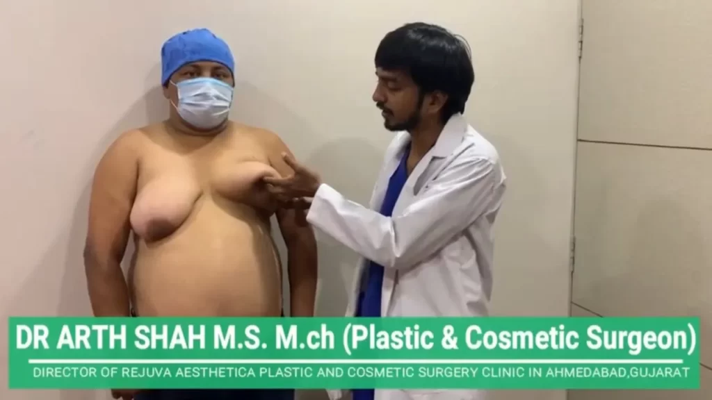 Gynecomastia का दुर्लभतम मामला आपने पहले कभी नहीं देखा होगा