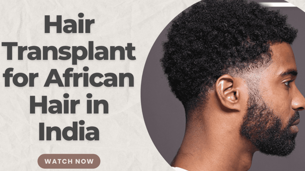 Patient from Africa came to India for Hair Transplant surgery.