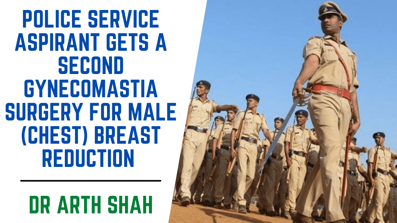Police service aspirant gets a second gynecomastia surgery for Male (chest) Breast Reduction