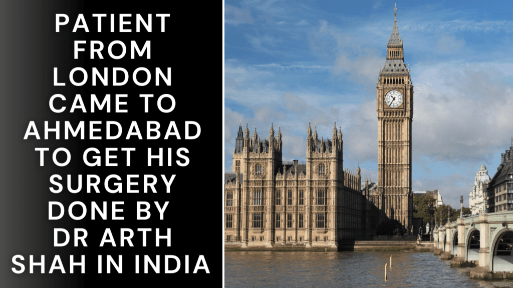 Gynecomastia Patient from London came to Ahmedabad to get his surgery done by Dr Arth Shah in India