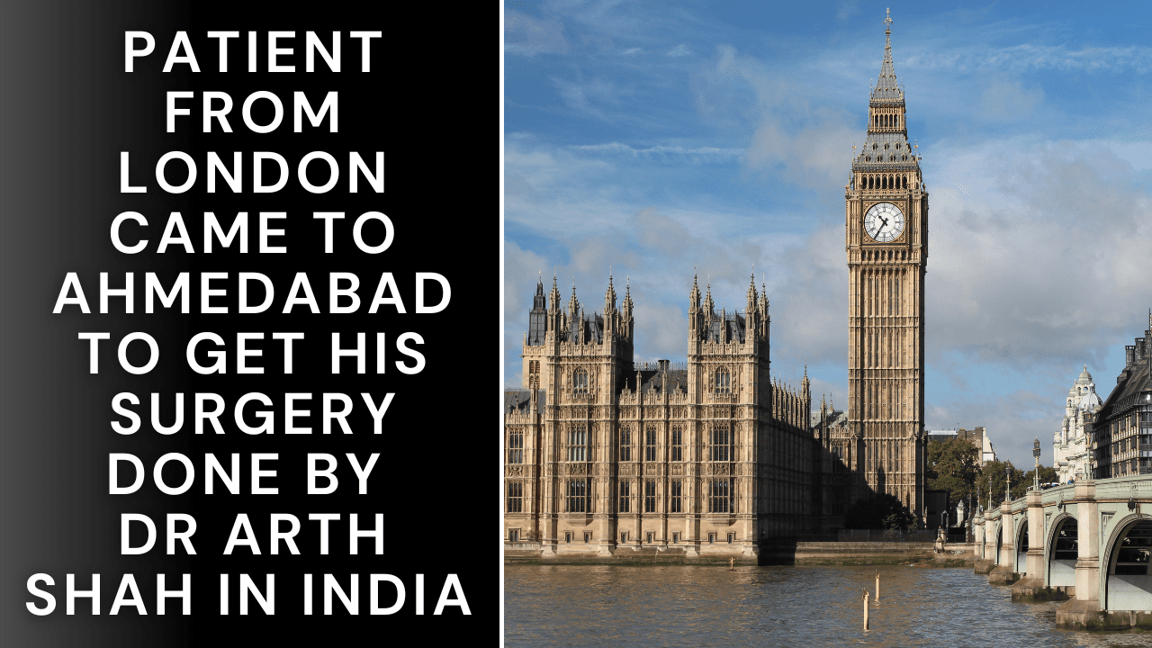 Male Breast reduction Patient from London came to Ahmedabad to get his surgery done by Dr Arth Shah in India