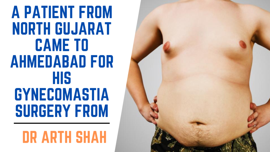A patient from North Gujarat Came to Ahmedabad for his Gynecomastia Surgery